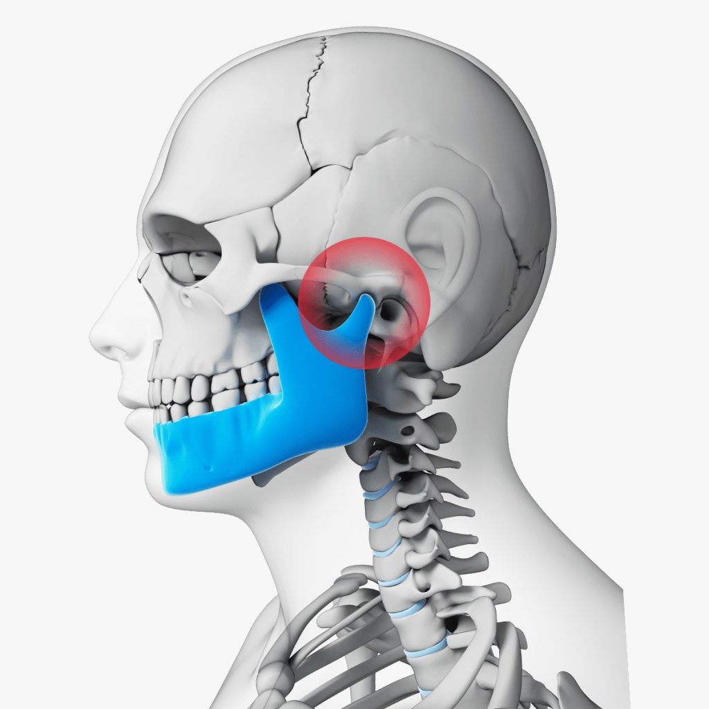 dolor articular ortodoncia